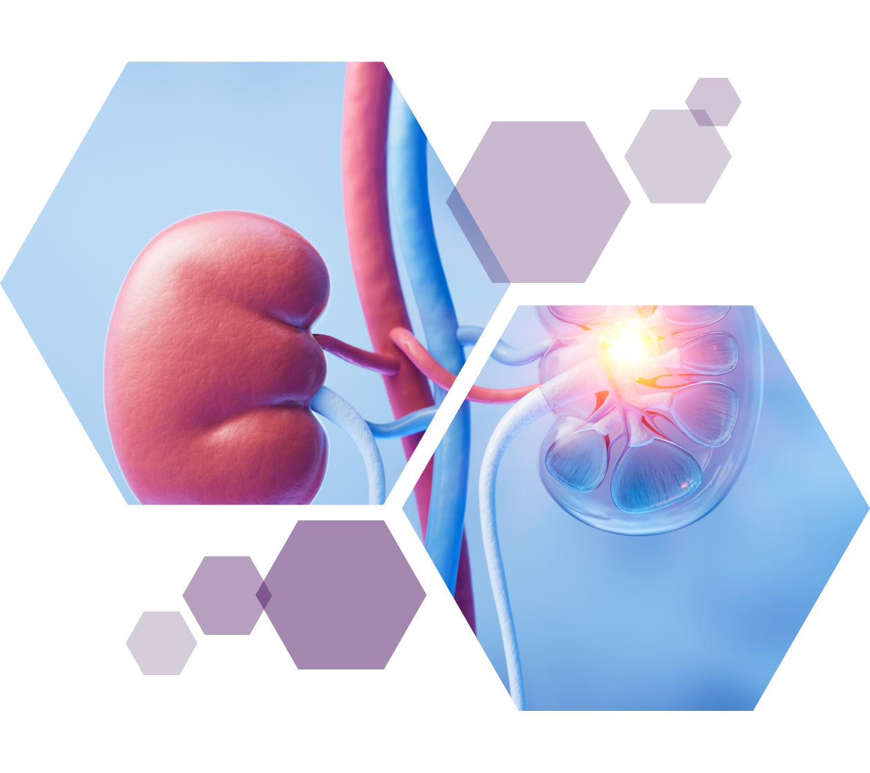 Redefining kidney health